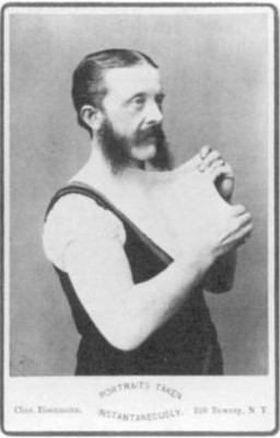 The Elastic-Skin Man (Felix Wehrle)