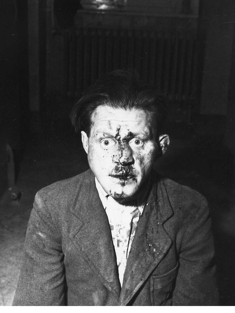 Buchenwald. Φύλακας που κακοποιήθηκε αλλά γλίτωσε τον θάνατο όταν συνελήφθη από Αμερικανούς στρατιώτες.