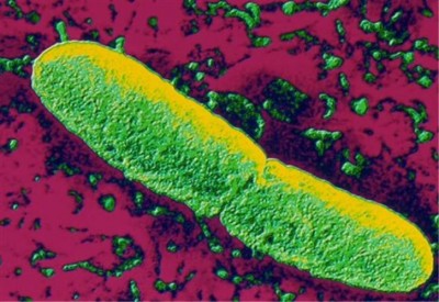Ιαπωνία, ΗΠΑ και ΕΕΣΔ φέρονται να είχαν αναπτύξει μεταλλάξεις του μικροβίου της πανώλης. Τα βιοχημικά όπλα είναι εκτός νόμου με τη συνθήκη της Γενεύης του 1972 