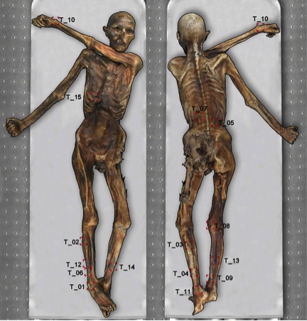 otzi1