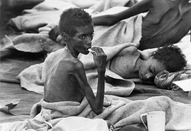 Θύμα της ασιτίας στην Αιθιοπία
