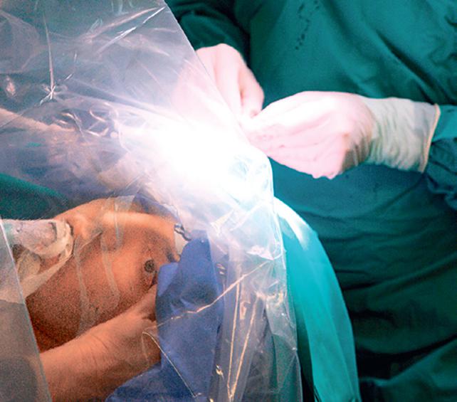Την ώρα που ο νευροχειρουργός βρίσκεται επί το έργον, ο ασθενής ανοίγει τα μάτια και απαντάει σε ερωτήσεις Φωτογραφίες Παναγιώτης Σαρρής
