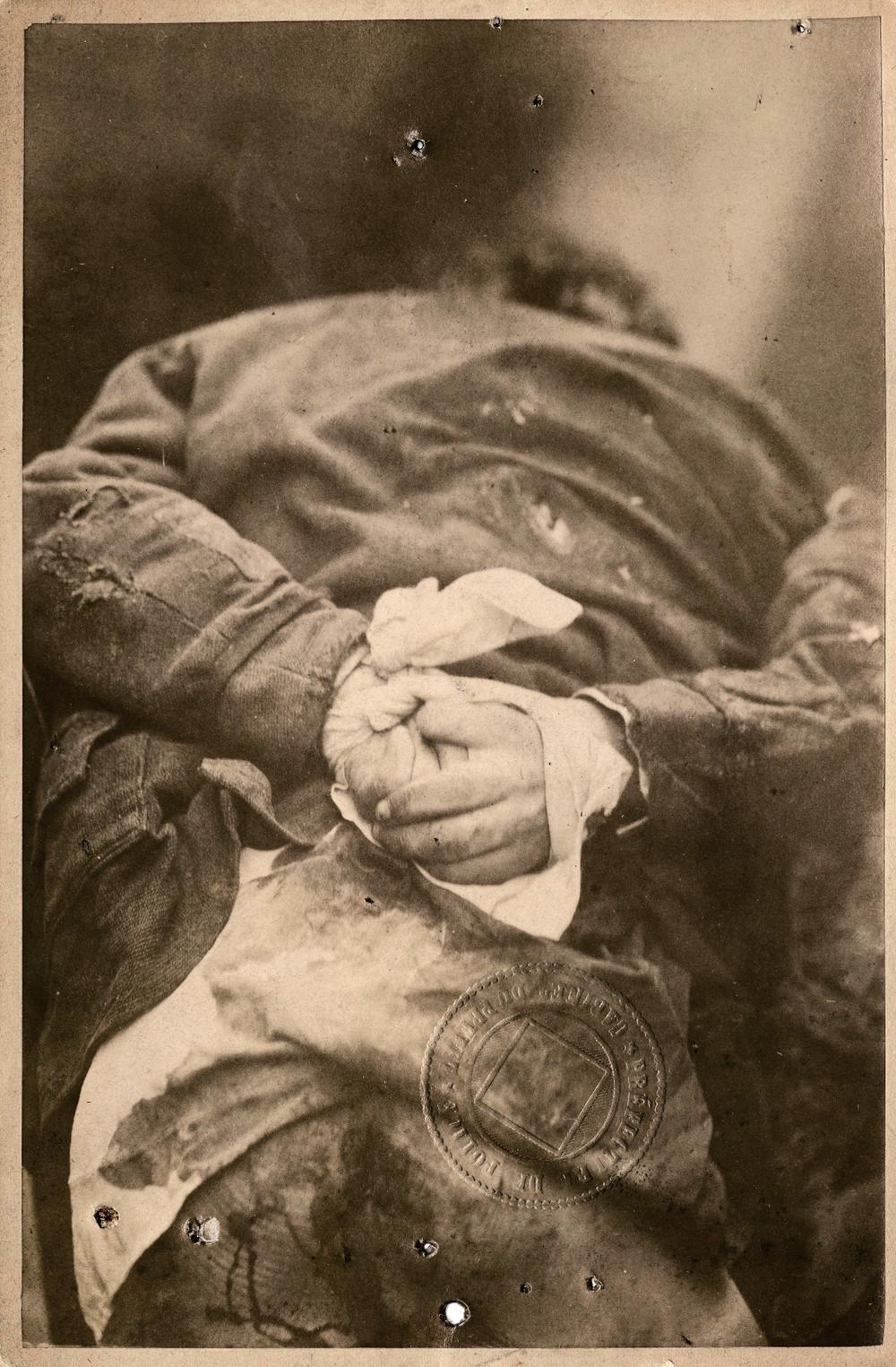 Ο 6χρονος Ζουλς Σένεν βρέθηκε νεκρός στις 25 Φεβρουαρίου του 1881. Δολοφόνος ήταν ένας 16χρονος. Το θύμα βρέθηκε με δεμένα τα χέρια, το παλτό του τρύπιο και το πουκάμισό λερωμένο με αίμα. Ήταν η πρώτη υπόθεση που χρησιμοποιήθηκε η φωτογραφία.