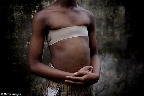 Οι πλούσιες οικογένειες του Καμερούν αντί για πέτρες και πυρωμένη σπάτουλα, χρησιμοποιούν έναν λαστιχένιο ιμάντα που προκαλεί δύσπνοια στα ανήλικα κορίτσια που το φορούν όλο το 24ωρο για πολλές εβδομάδες