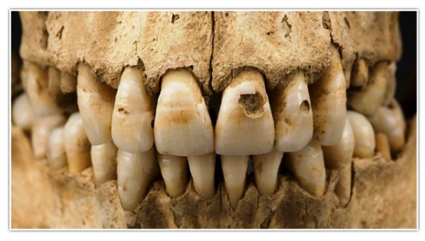 Identify_disease_in_bone_08