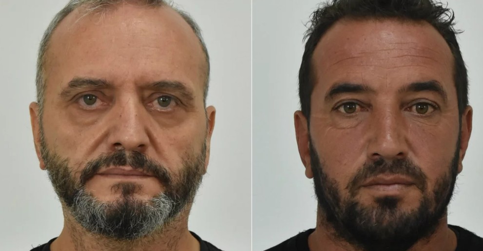 Κολωνός. Παραδέχτηκαν σεξουαλική επαφή με την ανήλικη. Μαρτύρια βόμβα από την πρόεδρο εκδιδομένων γυναικών