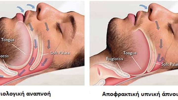 Κατά 2 ώρες μειώθηκε η μέση διάρκεια ύπνου στο δυτικό κόσμο. Οι επιπτώσεις από την έλλειψη ύπνου