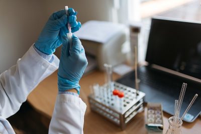 Η κυβέρνηση Τραμπ τερμάτισε χρηματοδότηση σε κρίσιμο πρόγραμμα για την αναζήτηση εμβολίου κατά του AIDS